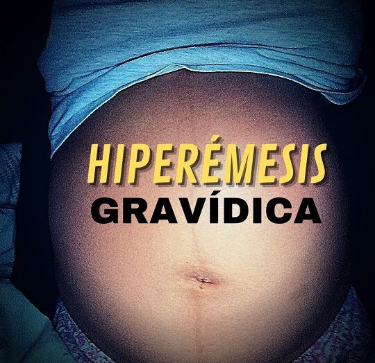 Hiperémesis Gravídica, una historia en 3 tiempos