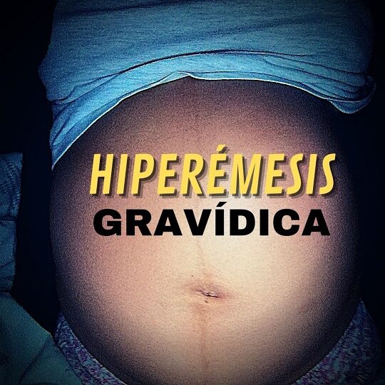 Imagen destacada